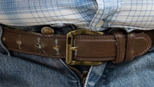 What causes obesity?