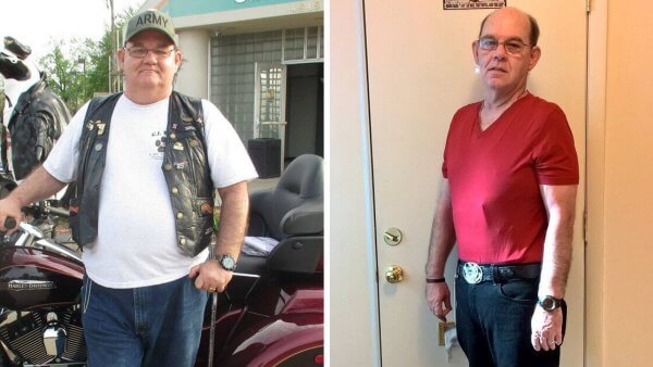 From 300 Pounds to 170 Pounds – Kelly’s Weight Loss Journey
