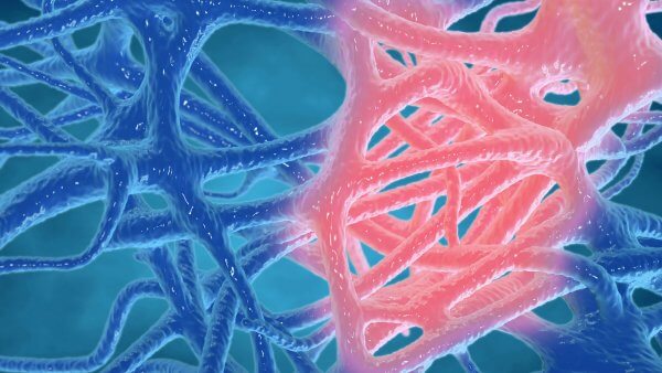 Inflammation: the Good, the Bad, and the Ugly
